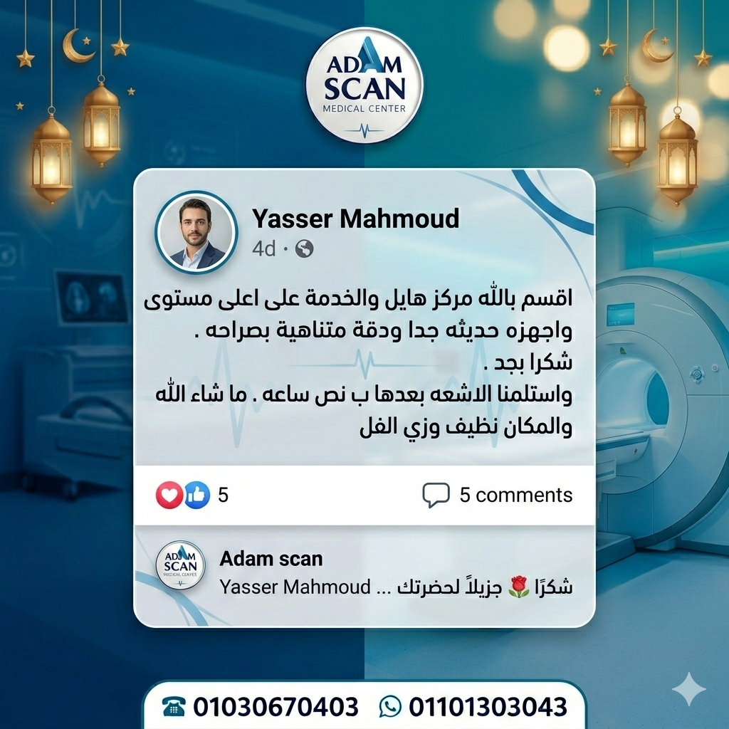 آراء العملاء آدم إسكان